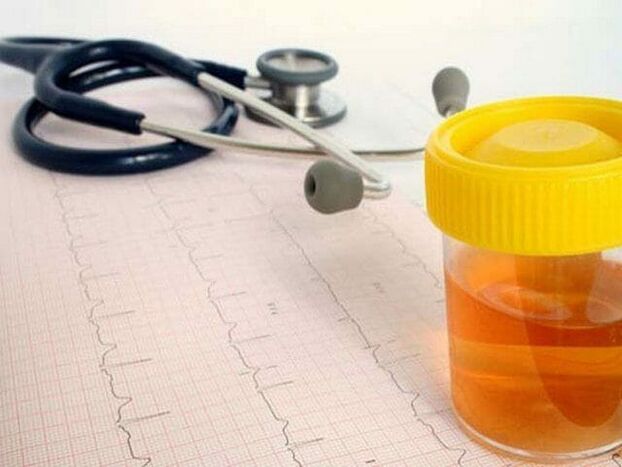 uriinianalüüs tsüstiidi diagnoosimiseks