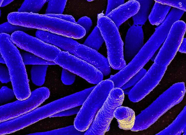 E. coli provotseerib kõige sagedamini tsüstiidi arengut naistel